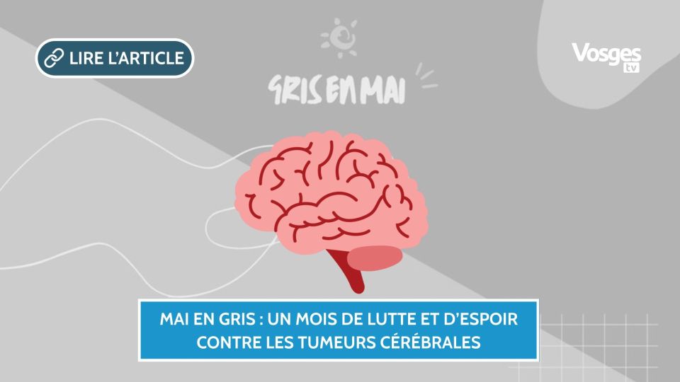 Mai en Gris : Un mois de lutte et d’espoir contre les tumeurs cérébrales